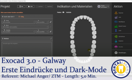 2021-Exocad - Exocad 3.0 -Galway Erste Eindrücke und Dark-Mode 
