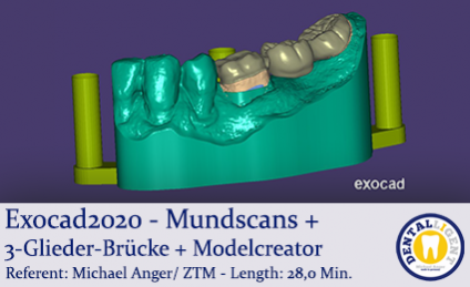 2020-Exocad - Exocad-Plovdiv – Mundscans + 3-Glieder-Brücke + Modelcreator 