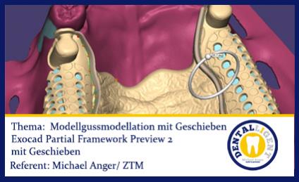 2016-FREE VIDEO! - EXOCAD 2016 - Modellgussmodellation mit Geschieben 