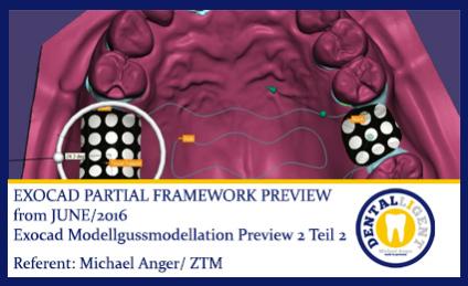 2016-EXOCAD -Exocad Modellgussmodellation Preview 2 Teil 2 