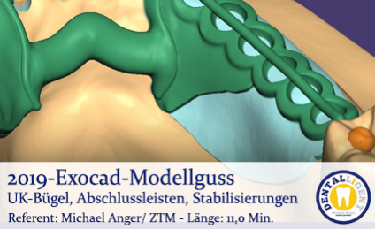 2019-Exocad Modellguss UK-Bügel, Abschlussleisten, Stabilisierungen 