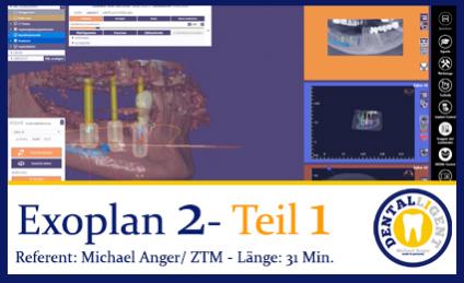 2019-Exocad  EXOPLAN 2 - Teil 1 