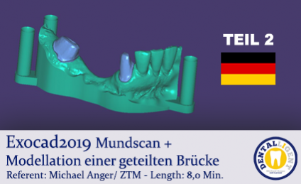 2019-Exocad - TEIL2 - Mundscan + Modellation einer geteilten Brücke 