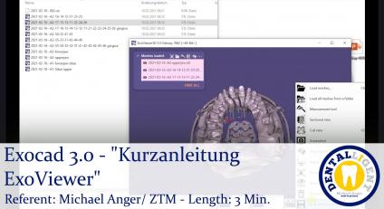 2021-Exocad - Exocad 3.0 – Galway  "Kurzanleitung ExoViewer" 