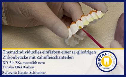 Individuelles einfärben einer 14-gliedrigen Zirkonbrücke mit Zahnfleischanteilen 