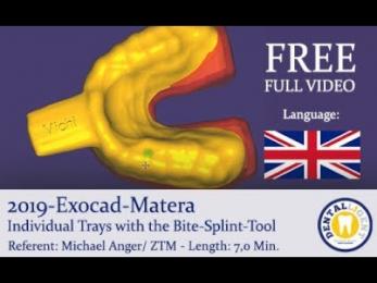 2019 - FREE FULL EXOCAD TUTORIAL - Exocad-Matera Individual Trays with the Bite-Splint-Tool 