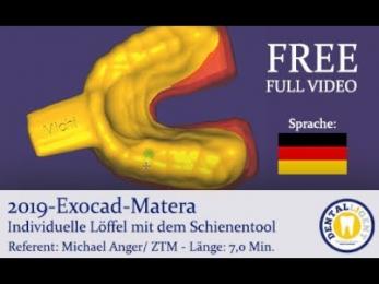 2019 - FREE FULL TUTORIAL -  Exocad-Matera Individuelle Löffel mit dem Schienentool 