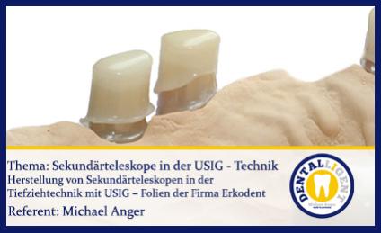 GRATIS - Sekundärteleskope in der USIG - Technik 