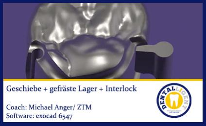 2017-exocad 6547 "Gratis" Geschiebe + gefräste Lager + Interlock 
