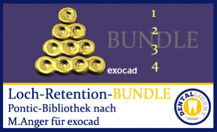BUNDLE - 1-2-3-4-Loch-Retentionen - nach Michael Anger für die Pontic-Bibliothek für exocad 