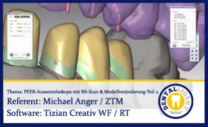 PEEK-Aussenteleskope mit Renishaw-Scan & Modellveränderung - Teil 2 