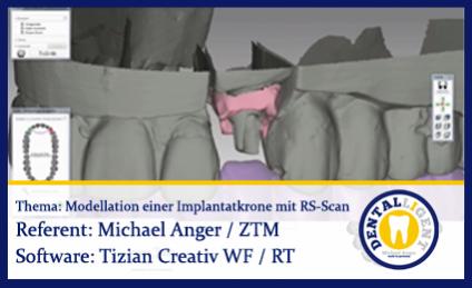 Modellation einer Implantatkrone mit Renishaw-Scan 