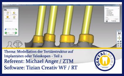Modellation der Tertiärstruktur auf Implantaten oder Teleskopen - Teil 2 