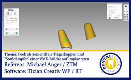 Peek als zementfreie Trägerkappen und “Stoßdämpfer“ einer VMK-Brücke auf Implantaten 