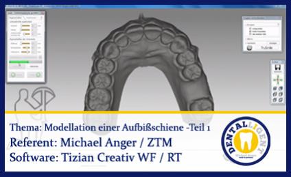 Modellation einer OK-Aufbissschiene - Teil 1 