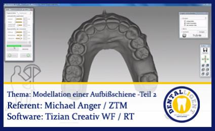 Modellation einer OK-Aufbissschiene - Teil 2 