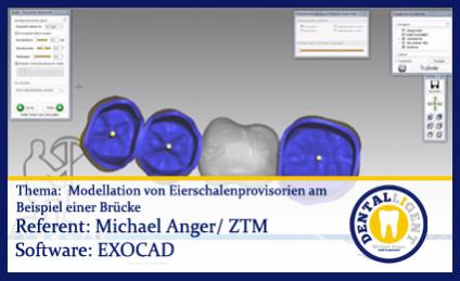 Modellation von Eierschalenprovisorien am Beispiel einer Brücke 