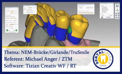 NEM-Brücke mit Girlande, TruSmile & Nachbearbeitung 