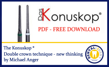 The Konuskop® - double crown technique 