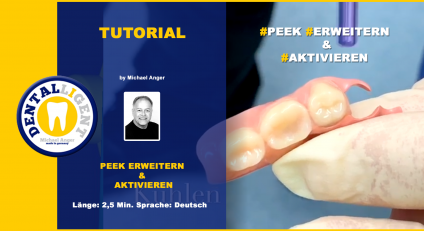 GRATIS - Thema: PEEK ERWEITERN & AKTIVIEREN 