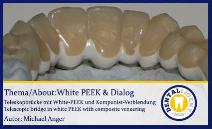 GRATIS-White PEEK & Dialog 