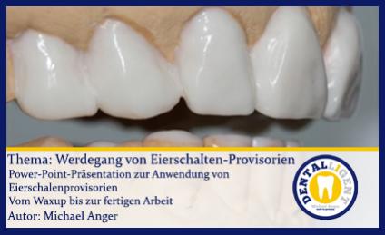 GRATIS - Thema: Werdegang von Eierschalen-Provisorien 