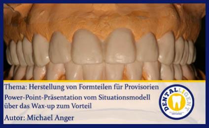 GRATIS - Thema: Herstellung von Formteilen für Provisorien 