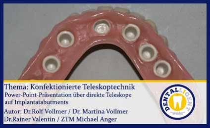 GRATIS - Konfektionierte Teleskoptechnik 