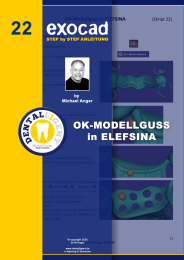 Exocad Step by Step Anleitung - Nr. 22 OK-Modellguss in ELEFSINA 