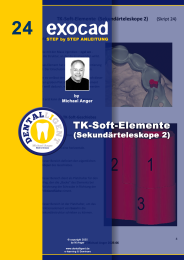 Exocad Step by Step Anleitung - Nr. 24 TK-Soft-Elemente (Sekundärteleskope 2) 