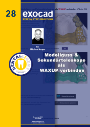 Exocad Step by Step Anleitung - Nr. 24 Digital die Kieferrelation vom Situ abnehmen 