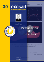 Exocad Step by Step Anleitung - Nr. 24 Digital die Kieferrelation vom Situ abnehmen 