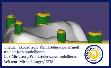 2016-FREE - NEW EXOCAD TUTORIAL 2016 Primärteleskope schnell und einfach modellieren 