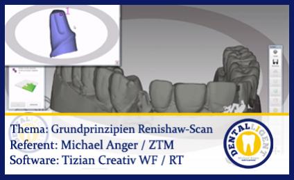 Grundprinzipien von einem Renishaw-Scan 