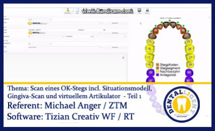 Scan eines OK-Stegs incl. Situ / Gingiva-Scan und virt. Arti. Teil 1 