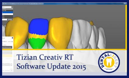 Free Video - Schütz Tizian Creativ RT Software Update 