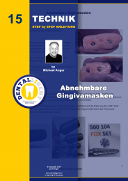 Technik Step by Step Anleitung - Nr. 15 Abnehmbare Gingivamasken 
