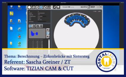 Berechnnung – Zirkonbrücke mit Sintersteg 