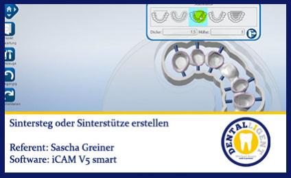 iCAM V5 smart- Sintersteg erstellen 