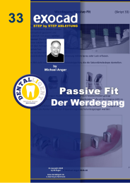 Exocad Step by Step Anleitung -Nr. 33 - Passive Fit 