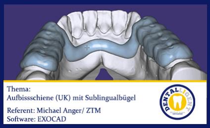 2016-EXOCAD  - Aufbissschiene (UK) mit Sublingualbügel 