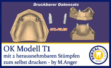 OK-Modell T1-STL-Daten zum selbst drucken 