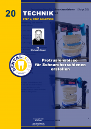 Technik Step by Step Anleitung - Nr. 20 Protrusionsbisse für Schnarcherschienen erstellen 