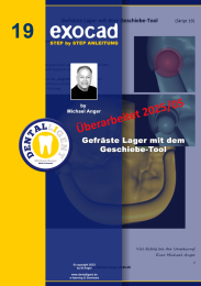 Exocad Step by Step Anleitung - Nr. 19 Gefräste Lager mit dem Geschiebe-Tool 