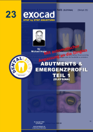 Exocad Step by Step Anleitung - Nr. 23 ABUTMENTS & EMERGENZPROFIL TEIL 1 in ELEFSINA 