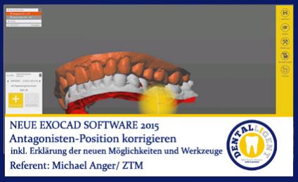 2015-Antagonisten-Position korrigieren - Exocad 2015 