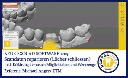 2015-Scandaten reparieren (Löcher schliessen) - Exocad 2015 