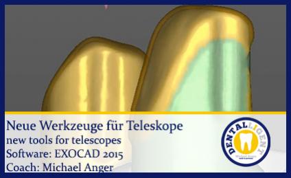 2015-Neue Werkzeuge für Teleskope 