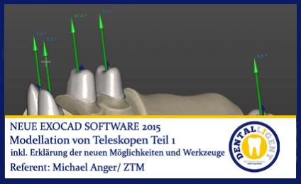 2015-Modellation von Teleskopen Teil 1 - Exocad 2015 