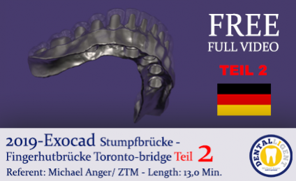 2019 - EXOCAD - TEIL 2 - TORONTO-BRIDGE - Fingerhutbrücke 